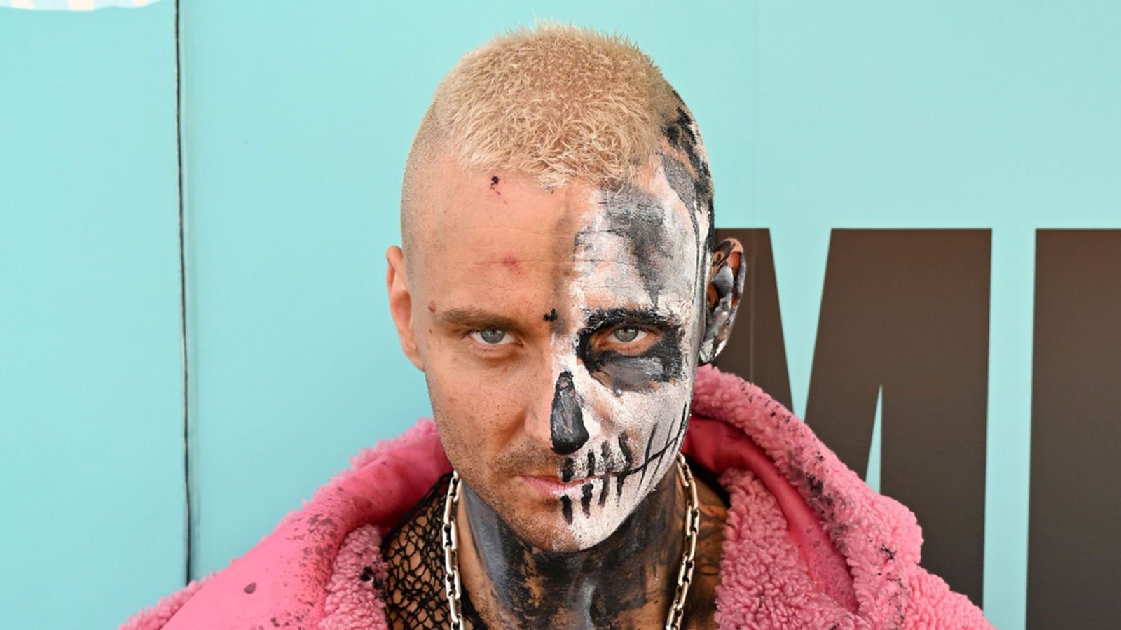 Update On Injury That Forced Darby Allin Out Of AEW Continental Classic
